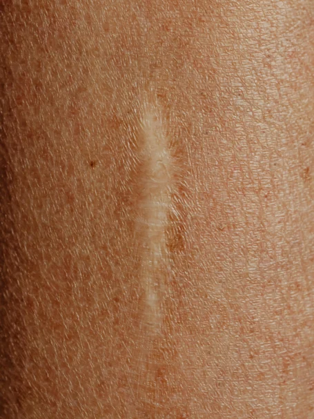 pexels-karola-g-6643073